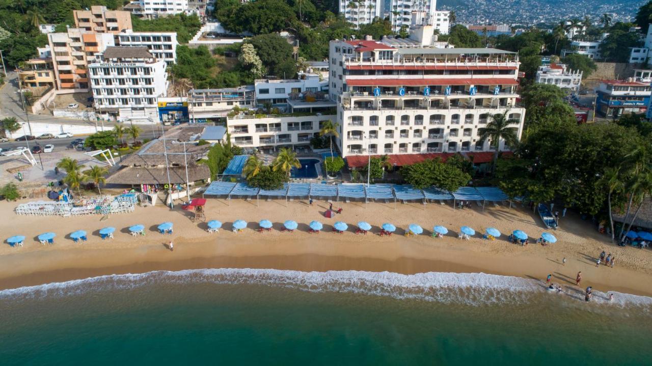 Acamar Beach Resort อากาปุลโก ภายนอก รูปภาพ
